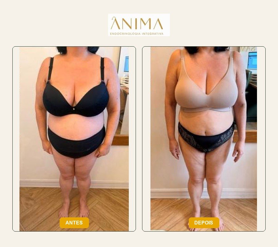 Comparação antes e depois fornecida na montagem — frente.
