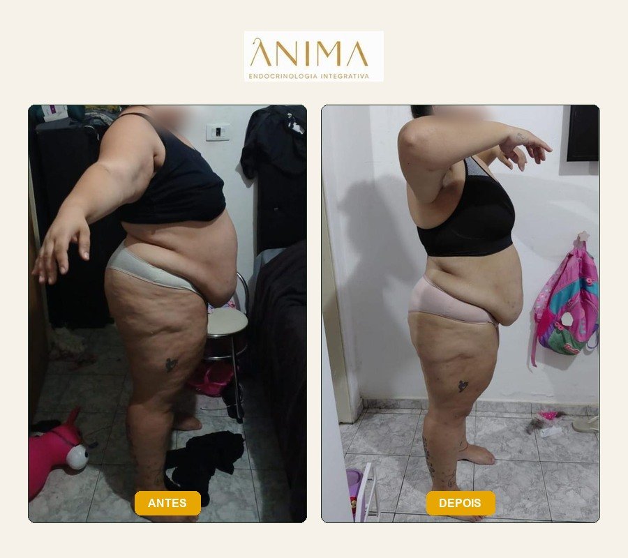 Comparação antes e depois fornecida na montagem.