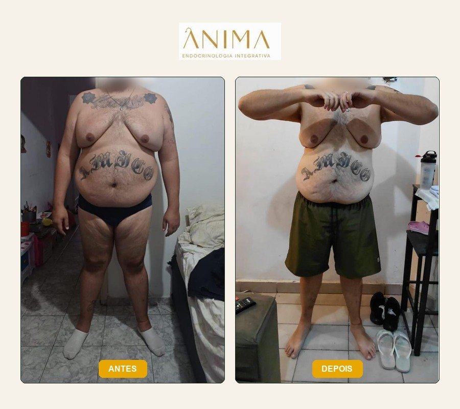 Comparação antes e depois fornecida na montagem.