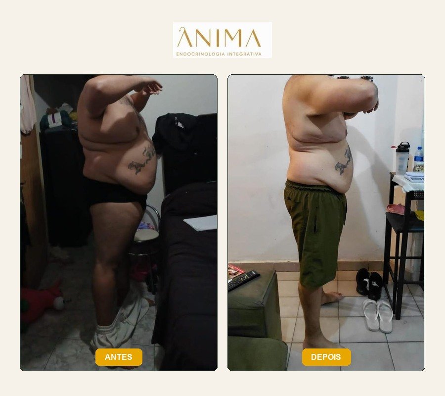 Comparação antes e depois fornecida na montagem.
