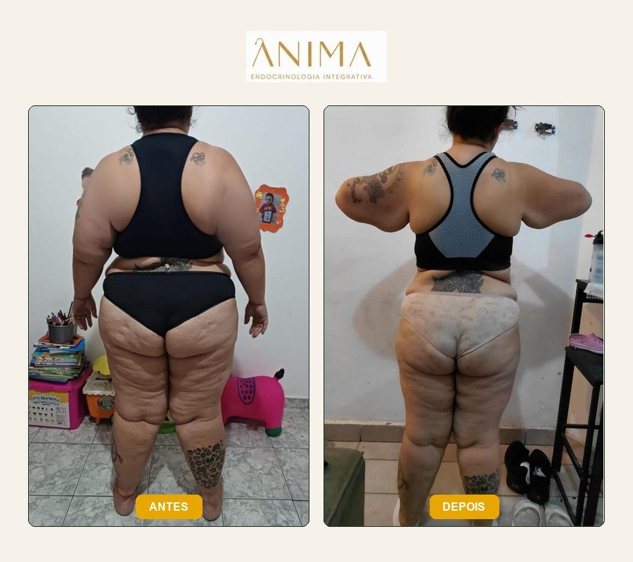 Comparação antes e depois fornecida na montagem.