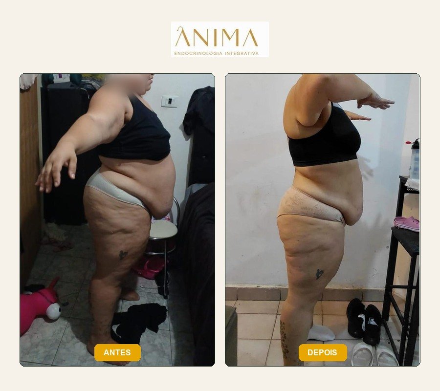Comparação antes e depois fornecida na montagem.