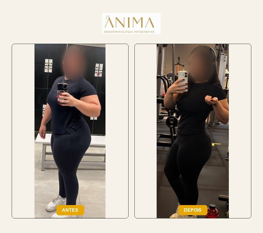 Comparação antes e depois fornecida na montagem.