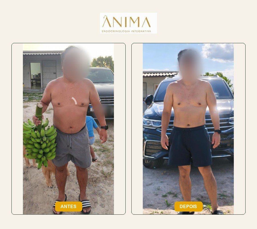 Comparação antes e depois fornecida na montagem.