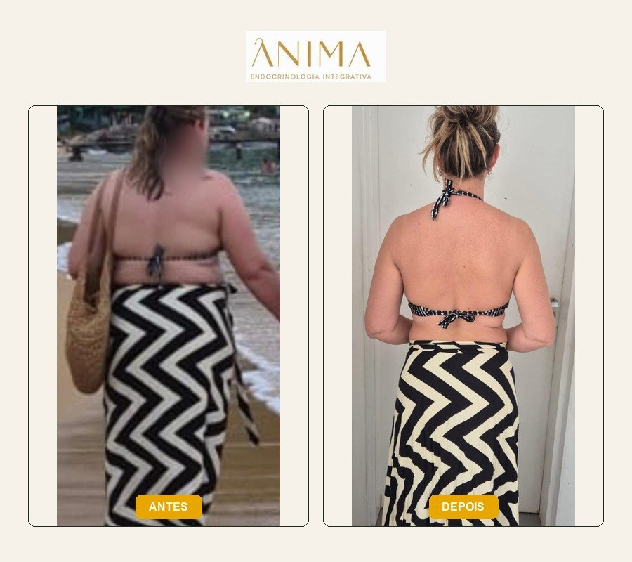 Comparação antes e depois fornecida na montagem.