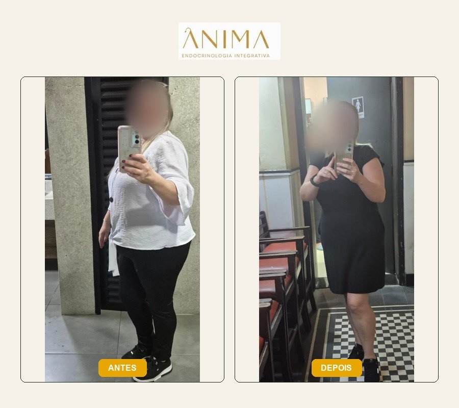 Comparação antes e depois fornecida na montagem.