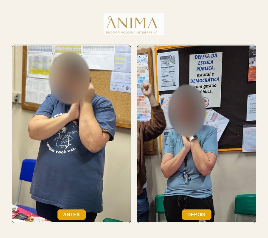 Comparação antes e depois fornecida na montagem, em uma comemoração.