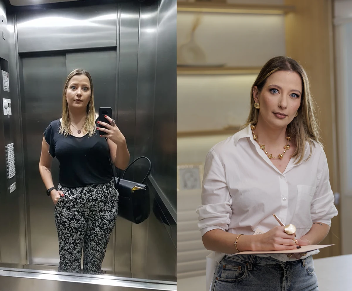 Antes e depois da Dra. Samara Zanin: à esquerda, uma selfie no elevador; à direita, um retrato no consultório.